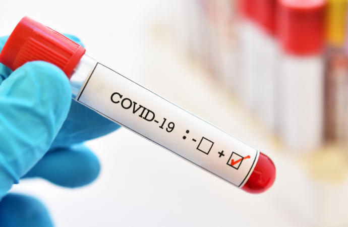 Uganda confirms 6 new COVID-19 cases